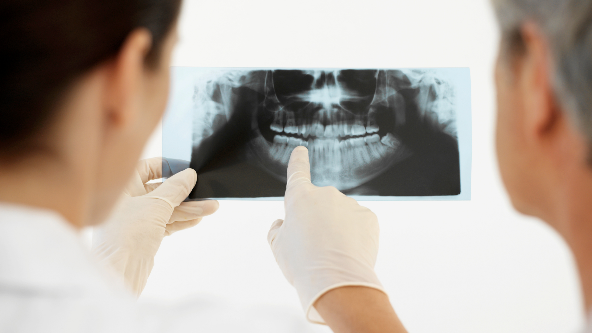 Насколько опасна лучевая нагрузка в стоматологии?